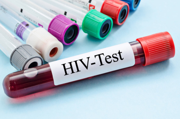 hiv sida