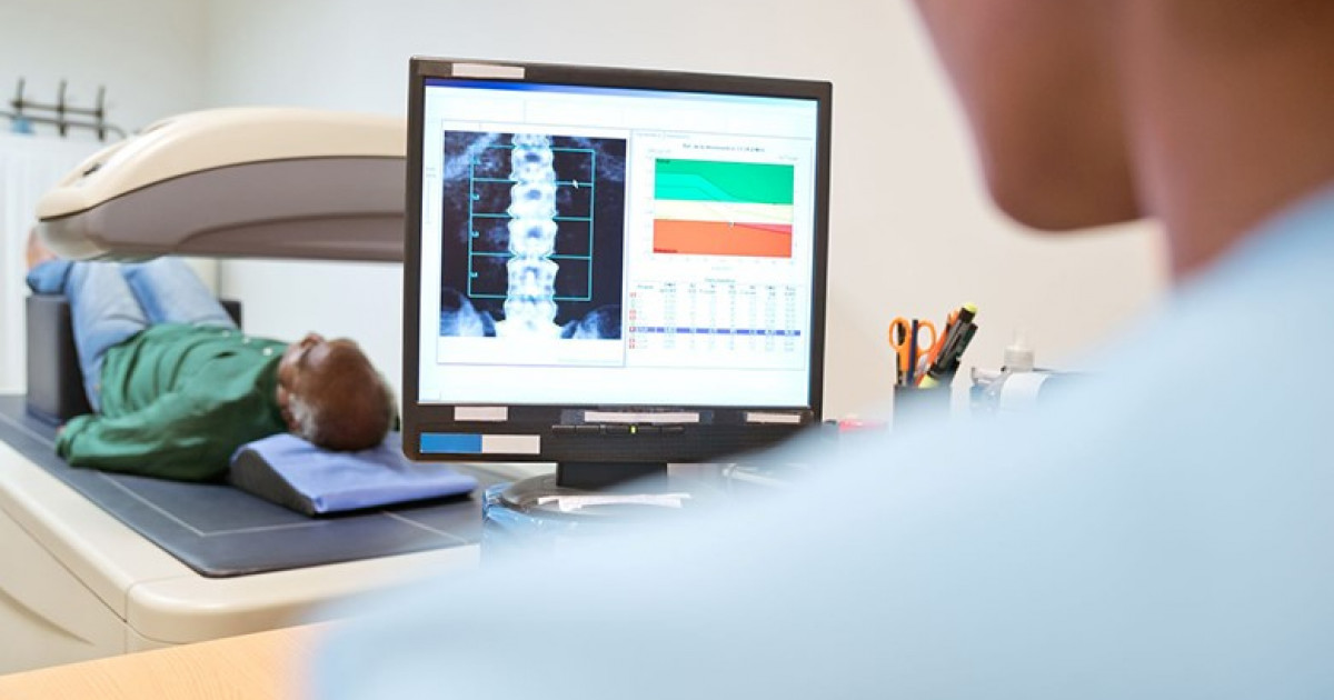 De ce trebuie diagnosticată precoce osteoporoza Digi