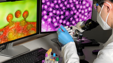 Laboratory technician doing research with images of HIV on a computer.