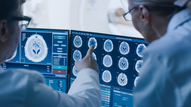 medici analizează radiografii ale creierului