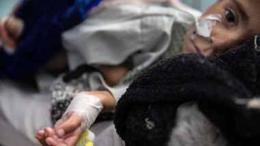 copil afgan subnutrit cu perfuzie in mana, intins pe pat la spital