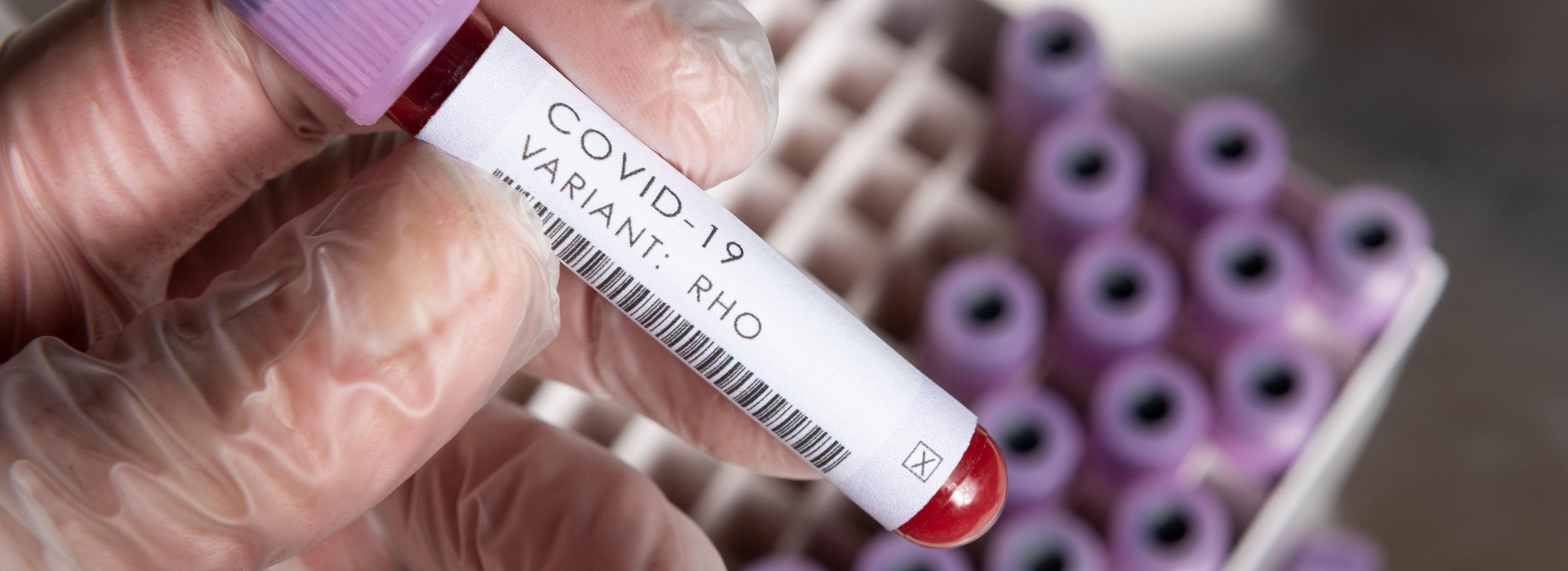 WHO covid-19 SARS variants of concern or interest of coronavirus, blood sample positive result for variant held in latex gloved hand