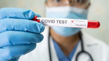 Un cadru medical arată un test pentru COVID-19.