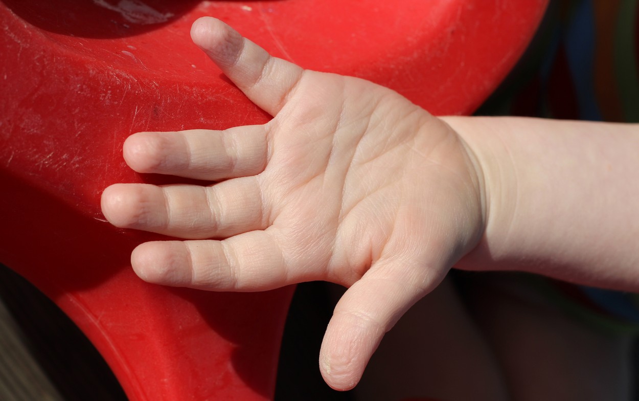 Fetița de 2 ani găsită decedată, cu vânătăi pe corp, nu a avut o moarte violentă. Mama a sunat la 112, după ce copila nu s-a mai trezit