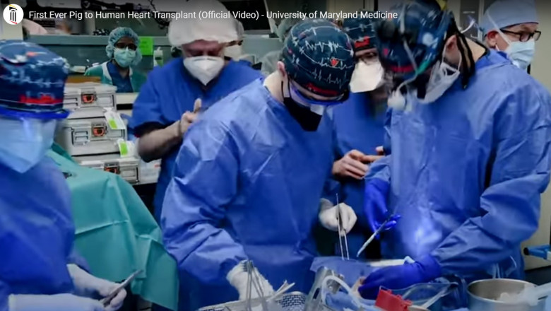 medici chirurgi in timpul unui transplant