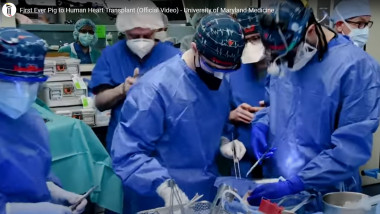 medici chirurgi in timpul unui transplant
