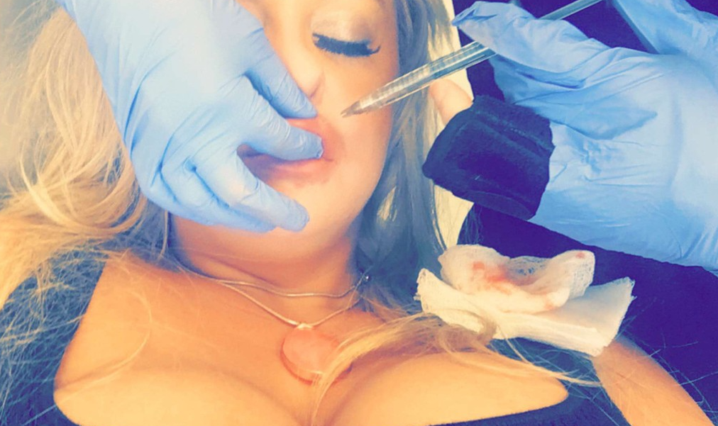 Un alt medic estetician fals a fost descoperit de polițiști. Femeia se lăuda cu zeci de cliente și se promova pe rețelele sociale