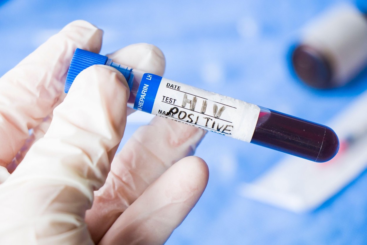 O echipă de cercetători a anunțat că este posibil să fi vindecat o femeie de HIV