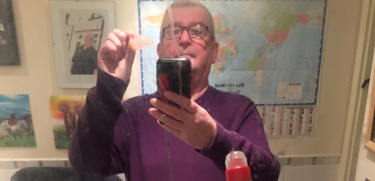 Un britanic și-a recuperat proteza dentară pierdută după o beție în Spania în urmă cu 11 ani