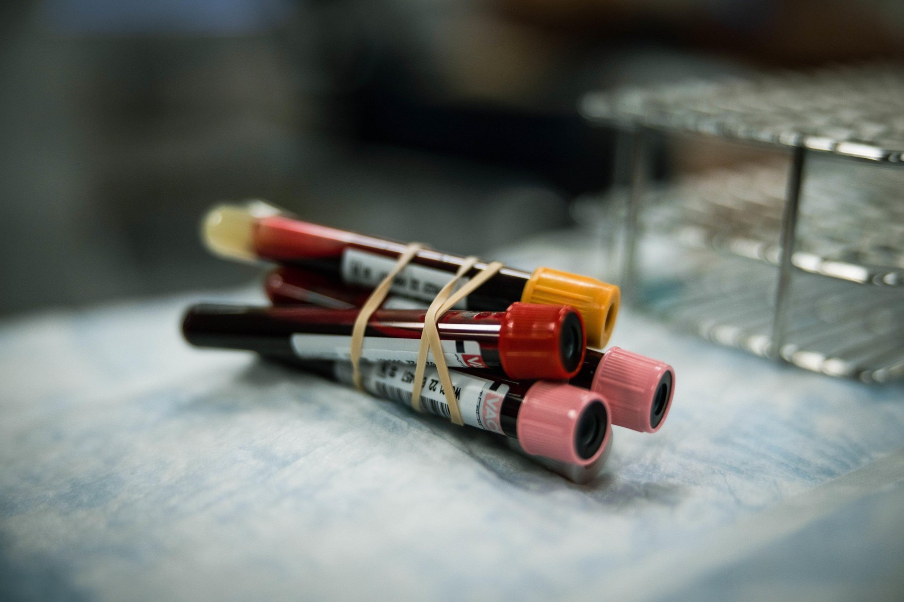 Particule de microplastic au fost descoperite pentru prima oară în sângele uman