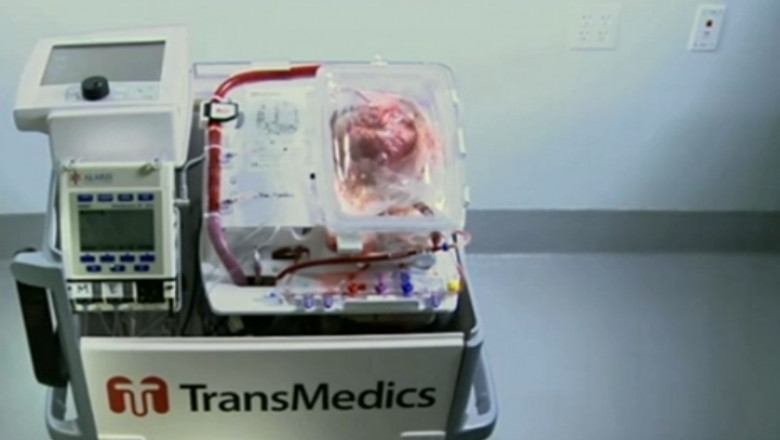 aparat transplant inima