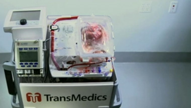 aparat transplant inima