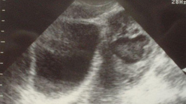 ultrasonografie pacienta