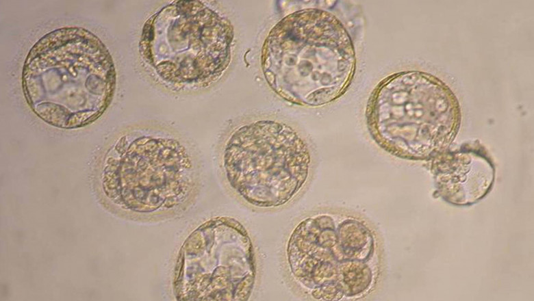 Clone de embrioni umani Coreea de Sud GettyImages-2973547