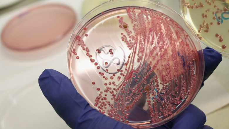 E.Coli GettyImages-115051151