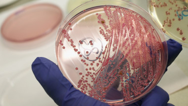 E-2.Coli GettyImages-115051151