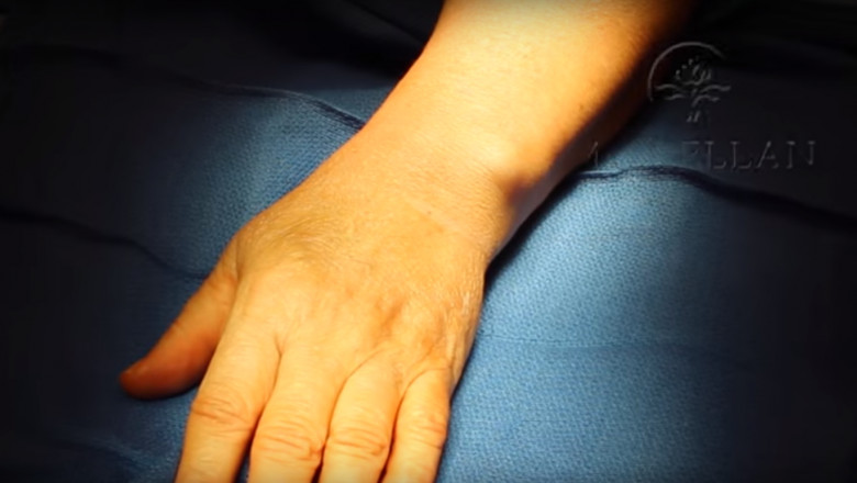 de ce durează articulația bera dureri articulare și furnicături