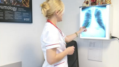 medic radiografie plamani