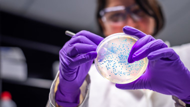 woman researcher performing examination of bacterial culture plate