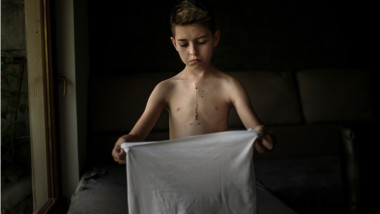 „Patric” copil operat pe inima se imbraca cu un tricou
