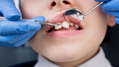 dentist stomatolog copil dinti