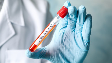 test coronavirus