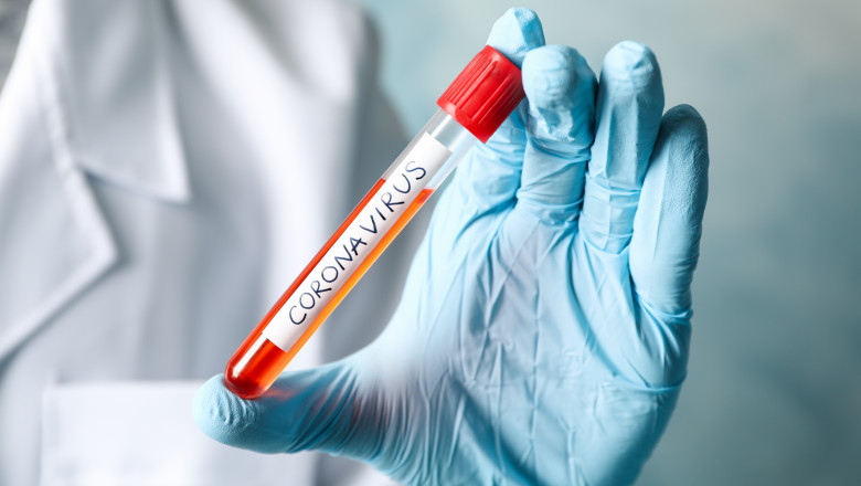 test eprubetă coronavirus, mănușă chirurgicală