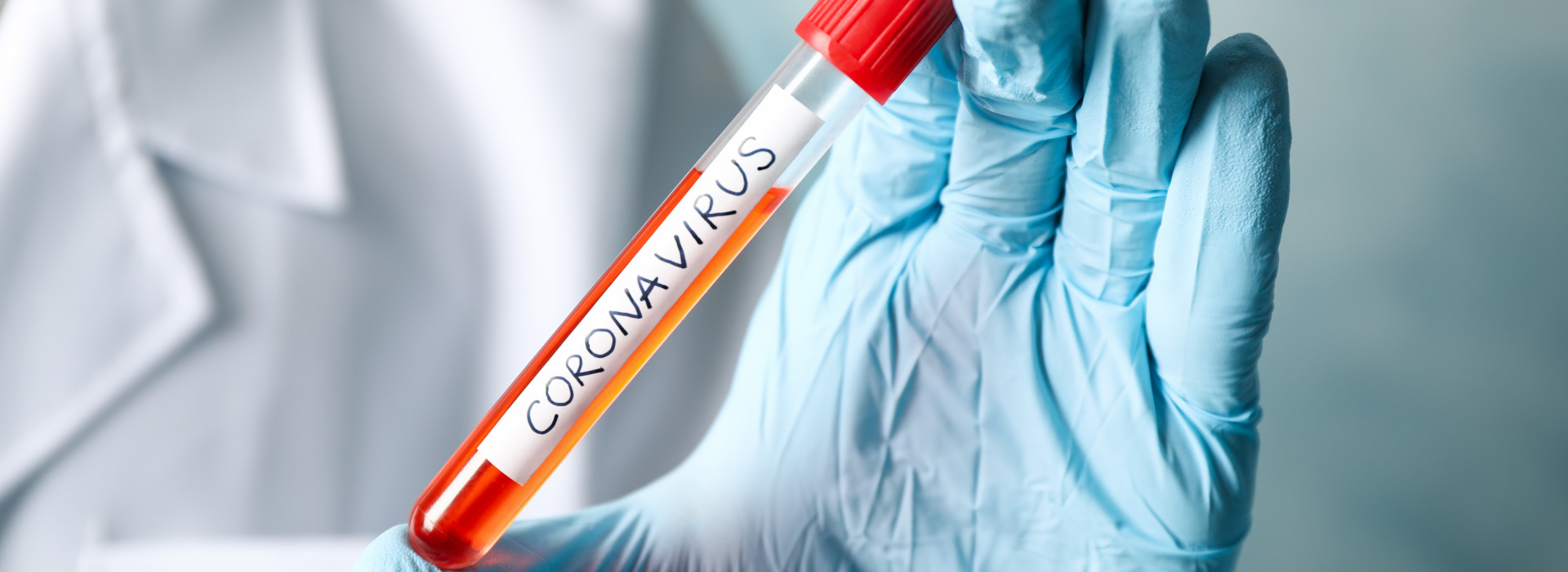 test coronavirus eprubetă