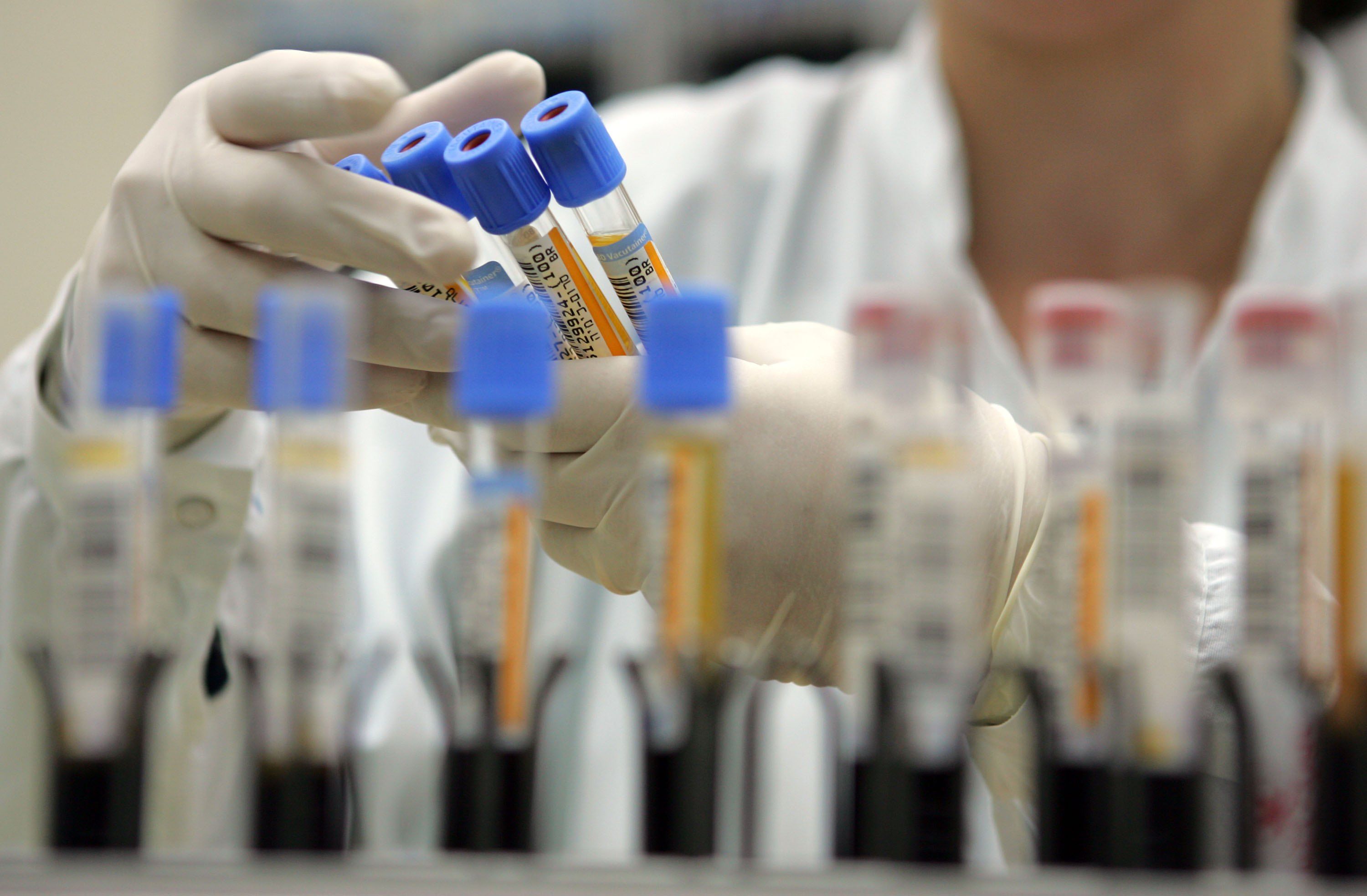 Un studiu dezvaluie cele 37 de proteine din sangele centenarilor ​​legate de o viata mai lunga si mai sanatoasa