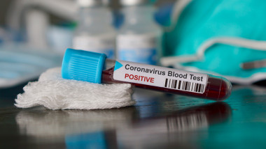 coronavirus covid-19 test pozitiv
