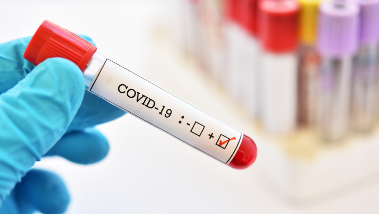 Blood sample tube positive with COVID-19