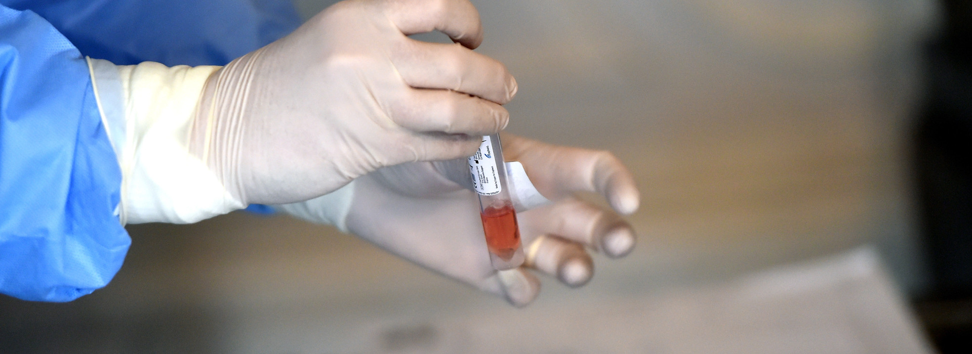 coronavirus DSP analize