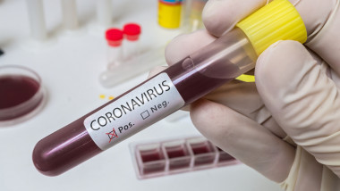 Hand holds test tube for Coronavirus 2019-nCOV analysis.