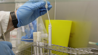 Berlin Laboratory Test For Swine Flu