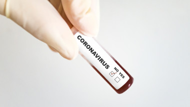 GettyImages coronavirus test negativ