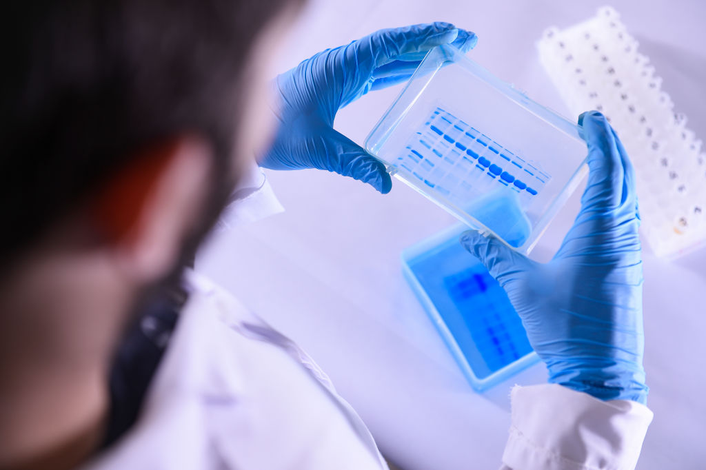 Au fost descoperite două "variante americane" ale SARS-CoV-2. Una dintre ele a evoluat rapid în Ohio, în câteva săptămâni
