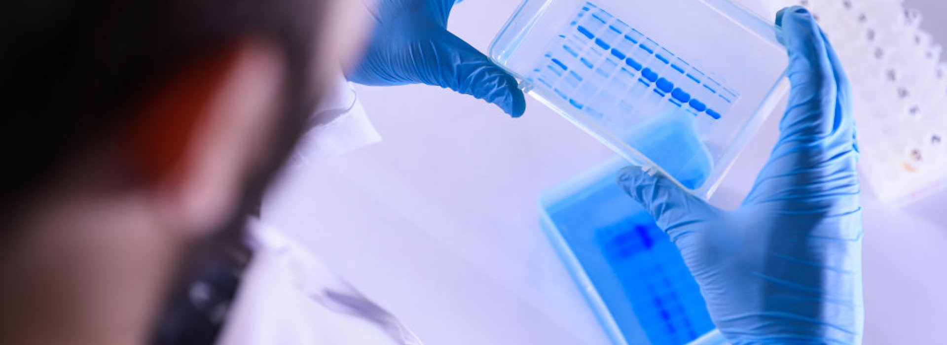 The Technological Vaccine Center of the Federal University of Minas Gerais is Testing a Vaccine against the Coronavirus (COVID - 19) and also Testing Diagnosis Kits