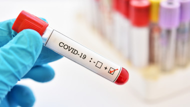 test pozitiv coronavirus covid 19
