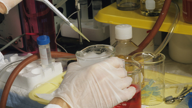 AIDS research in Biomedical laboratory, close-up