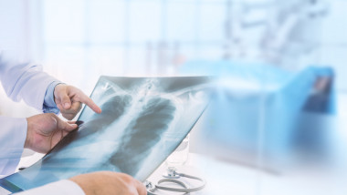 Un medic examineaza o radiografie pulmonara