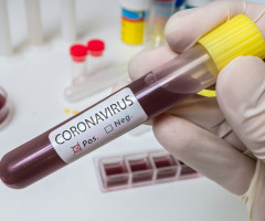 Opt români plecați la muncă în Franța, infectați cu noul coronavirus. MAE, notificat de autoritățile franceze