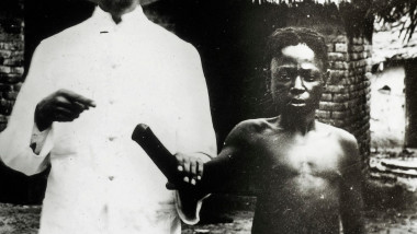 copil cu manata taiata in Congo colonial