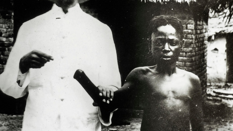 copil cu manata taiata in Congo colonial