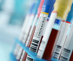 Focar de COVID la un abator din Belgia. Printre angajații infectați sunt și români