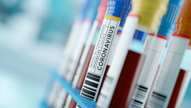 Probe de sange pentru COVID, depozitate intr-un laborator