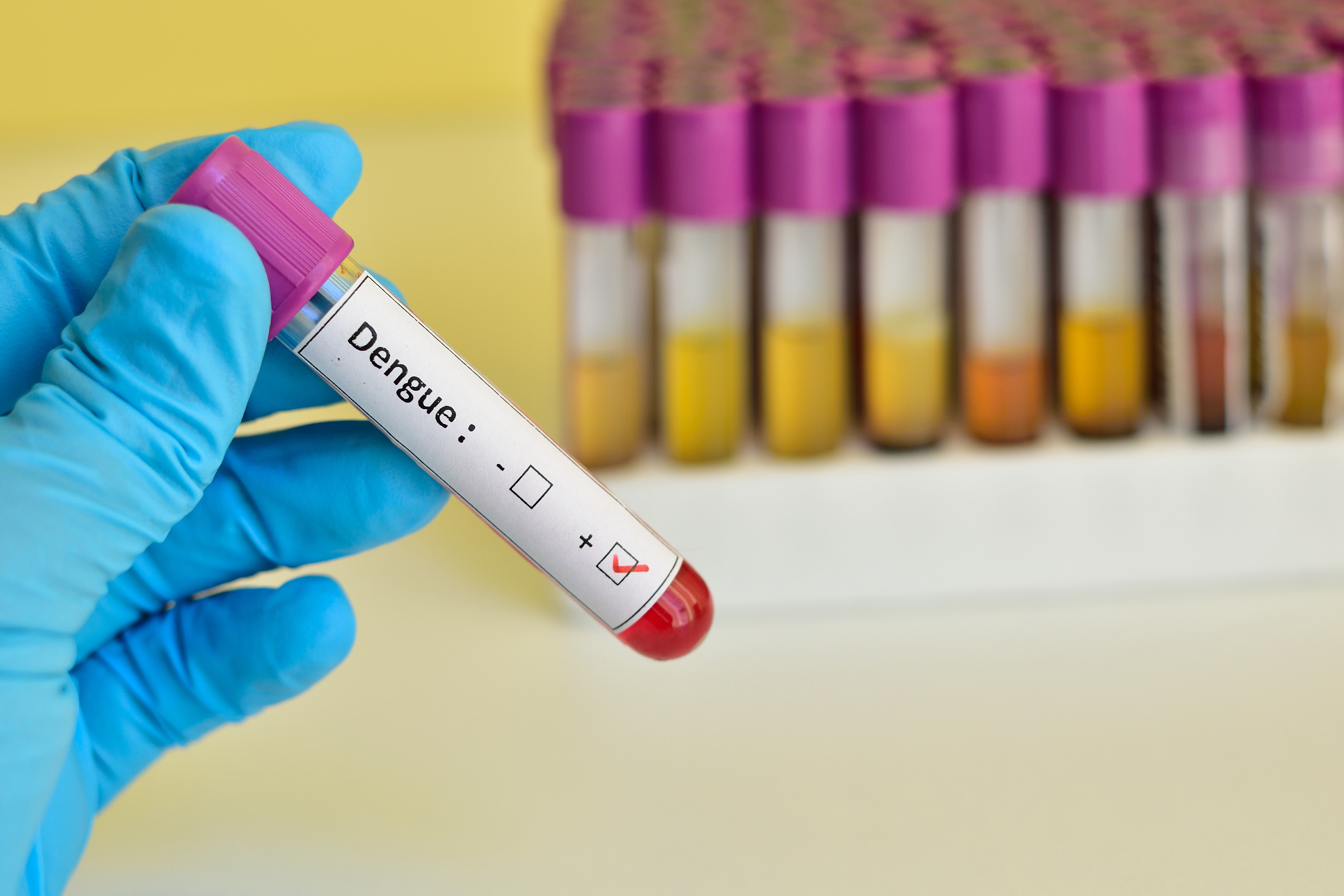 7,6 milioane de cazuri de febră dengue în 90 de țări, inclusiv în Europa. OMS este în alertă: Riscul de răspândire e ridicat