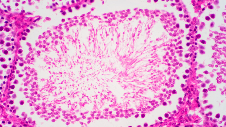 sperma umana la microscop