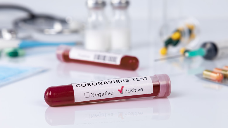 Teste coronavirus