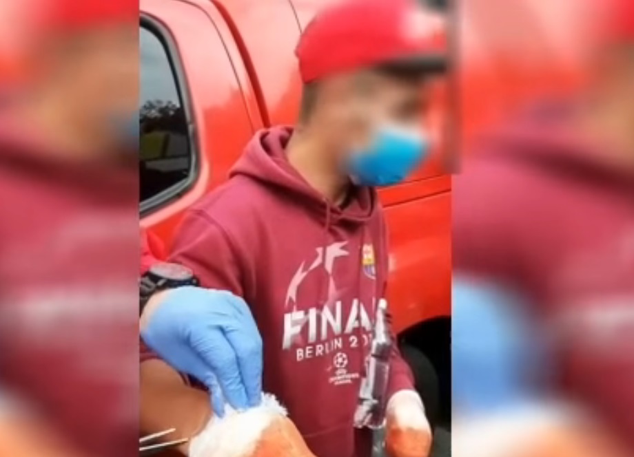 Un bărbat care a vrut să îi păcălească pe pelerini arătându-le mâinile însângerate, amendat după ce i s-au desfăcut bandajele