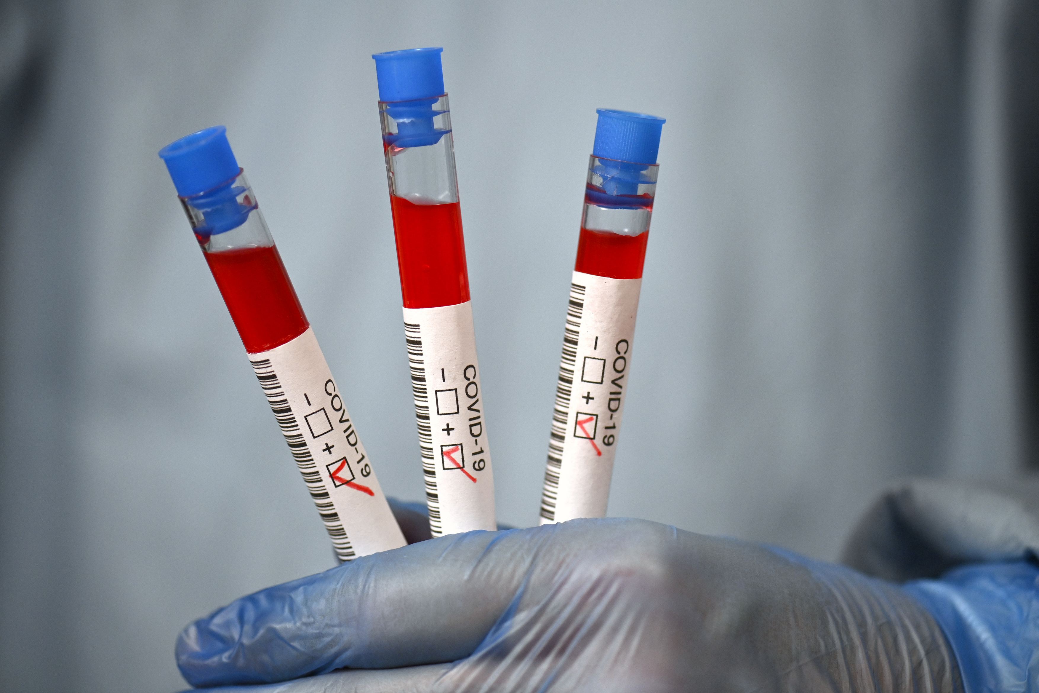 Au fost actualizate definițiile de caz pentru coronavirus. Categoriile care trebuie testate de cel puțin 2 ori pe lună